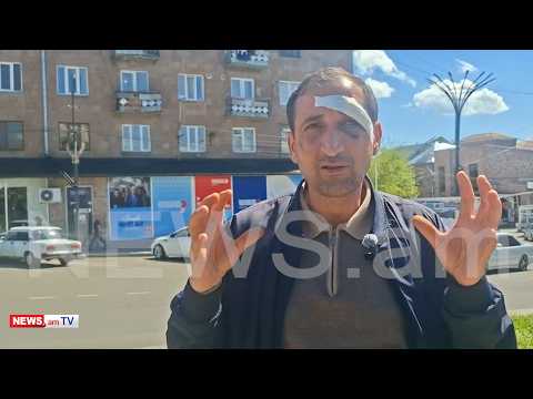 ՔՊ-ն խմբակներ է ձևավորում ընդդիմադիր ակտիվիստներին չեզոքացնելու համար. Արթիկում ծեծված բնակիչ