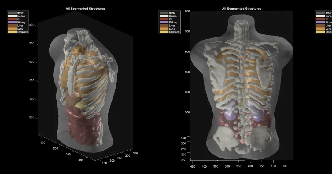 Midjourney Medical goes from generating ‘cat images’ to full-body ultrasound scans