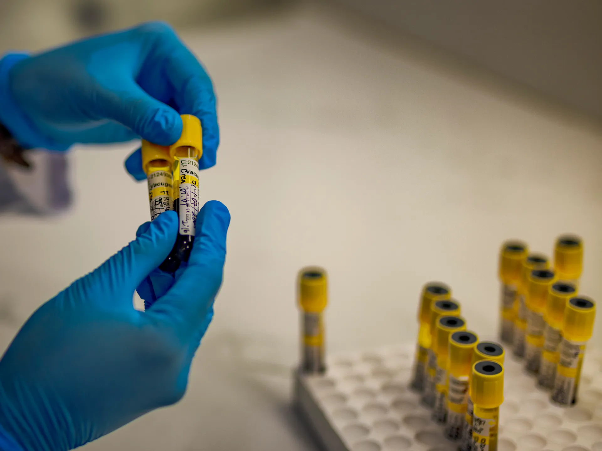 An AIDS-free generation is within reach, but not guaranteed