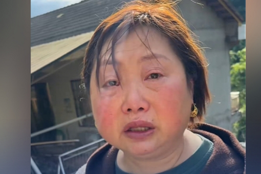 打一针就能瘦？注射“减重针”，四类人群应该“避雷”